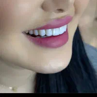 آف تابستانه کامپوزیت