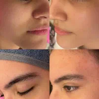 فیشال و پاکسازی پوست و کفسابی