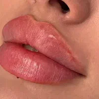 تزریق فیلر۵۵۰آف خورده به شرط اصل بودن مواد