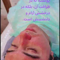 پاکسازی و فیشال صورت آقایان درلارستان