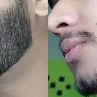 کاشت بدردت نمیخوره