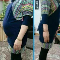 لاغری تضمینی