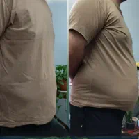 کلینیک تخصصی لاغری قطعی