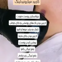 آموزش تخصصی پاکسازی و فیشال پوست با دستگاه|خدمات آموزشی|شاهین‌شهر, عطار|دیوار