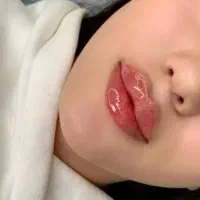 تزریق ژل و بوتاکس،تزریق چربی،لیفت نخ و prp