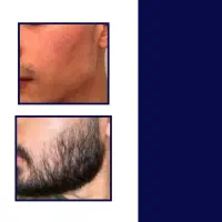 مرد باش|آرایشی، بهداشتی، درمانی|بابل, |دیوار