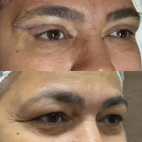 به چشماتون با بلفارو زیبایی بده