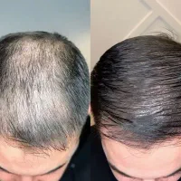 پرپشتی طلایی 2 ماهه