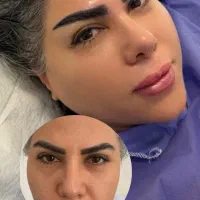 جشنواره ۶۰ درصدی میکرو‌کاشت تخصصی ابرو شیراز