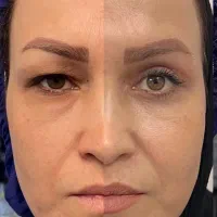 جراحی های پوستی