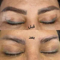 ریموو تتوی ابرو ایمن و فوری