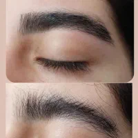 اصلاح صورت و ابرو تخصصی