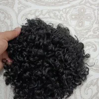 پروتز مو