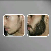 نتیجه میخوای درمانتو با ما شروع کن