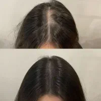 موهات حسابی پر پشت میشه