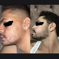 فول فیس شو
