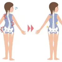حرکات اصلاحی