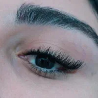 کاشت هیدن..لیفت ابرو