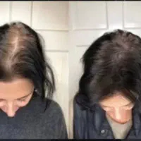 کاشت بدرد نمیخوره