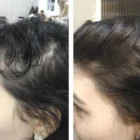 اگر کم‌پشتی مو داری، این آگهی برای توئه