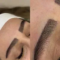 میکروکاشت ابرو