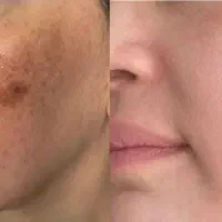 پوستت با این روش شفاف میشه