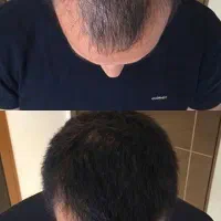 ارزیابی دقیق وضعیت مو