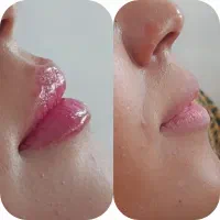تمام خدمات زیبایی