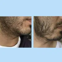 مرد شو|آرایشی، بهداشتی، درمانی|تویسرکان, |دیوار