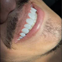 مدل کامپوزیت شو  فقط هزینه مواد ۱۰میلیون پرداخت کن