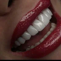 جشنواره تابستانه کامپوزیت لمینت