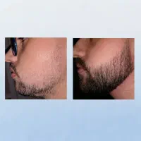 نتیجه گیری فوری