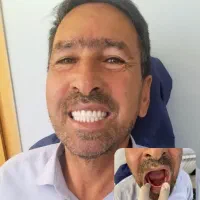 لابراتوار ساخت دندان مصنوعی (دندانسازی) خ،همدانیان