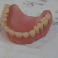 ساخت دندان متحرک