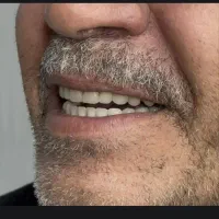 دندان سازی نیکو