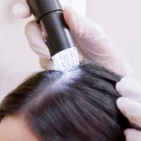 اسکالپ پاکسازی کف سر