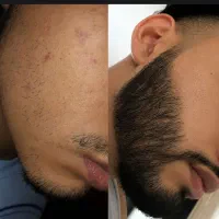 خدایی تاثیر داره رو چهرت