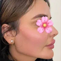 فیلر و بوتاکس