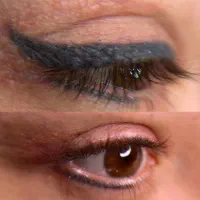 پاک کردن تک جلسه ای و تخصصی تاتو با جدیدترین تکنیک