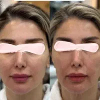 فیشال و پاکسازی تخصصی ساتی