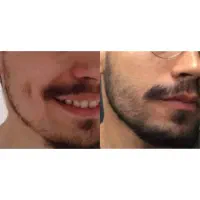 سبیل نداری فدا سرت