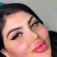 فیلر هیپدیب،باسن ،سینه ،بیکینی تخصص ماست