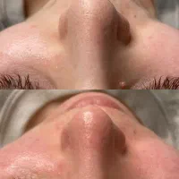 تخفیفات فشیال و پاکسازی