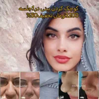 (کوچک کردن بینی فقط با1جلسه1200تومان) 50%تخفیف