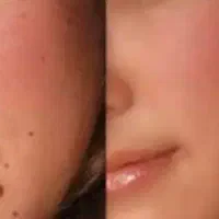 خال صورت