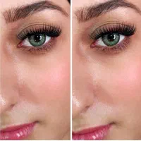 کاشت هیدن با ۲۰٪تخفیف