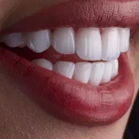 کامپوزیت سوییسی دندان با طرح طلایی شو