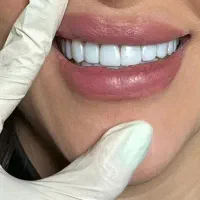 زیر قیمت بیمه،خدمات دندانپزشکی ۵۰٪ تخفیف حقیقی|خدمات زیبایی و سلامت|تهران, جمال‌زاده|دیوار