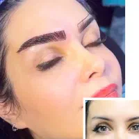 فرصت طلایی کاشت تخصصی ابرو با تخفیف ویژه