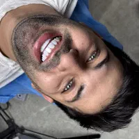 لمینت دندان